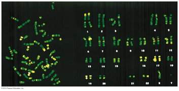 karyotype of human chromosomes