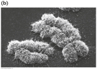 electron micrograph of human chromosomes